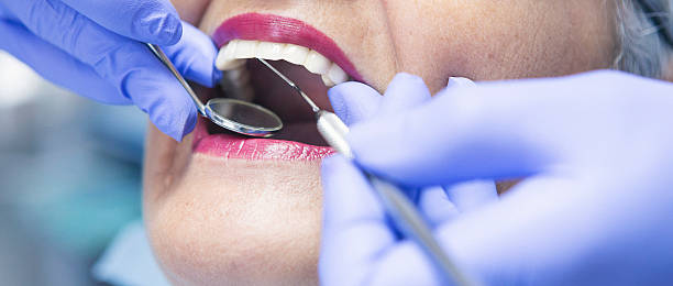 Best Emergency Treatment for Dental Infections or Abscesses in Saybrook On The Lake, OH